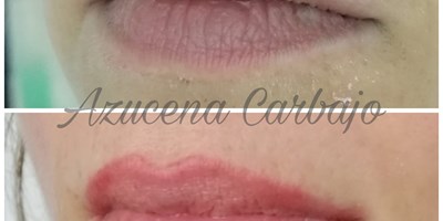 Micropigmentación en labios para efecto maquillaje permanente